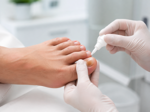 Fungal Nail Infection Treatment