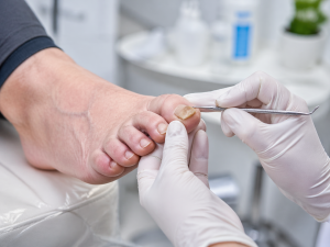 Thickened Nail Treatment